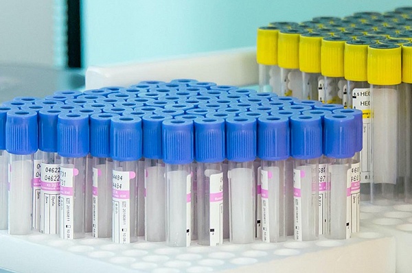 Пациенты поликлиники на Фитаревской могут сдать тест на антитела к COVID-19 в Щербинке